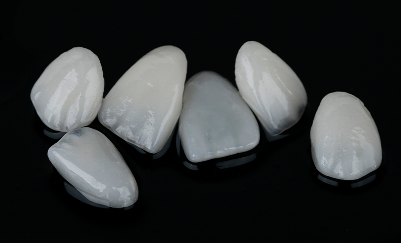 仮歯が割れたり欠けたりした場合