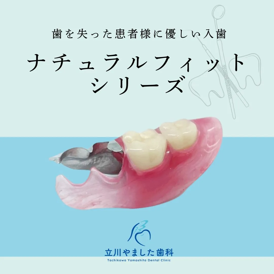 ナチュラルフィット入れ歯