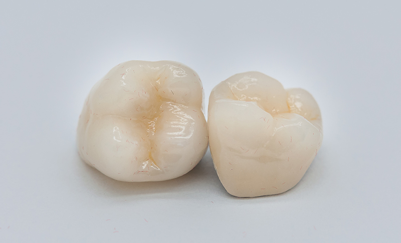 ジルコニアセラミック