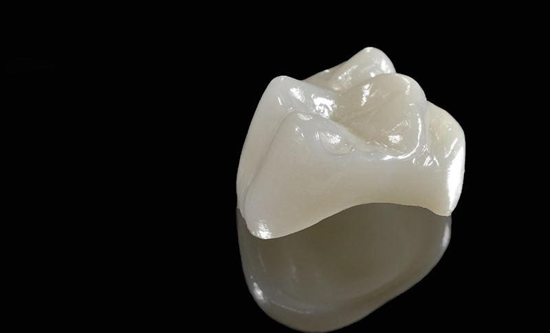 金属アレルギーの心配がない安全性