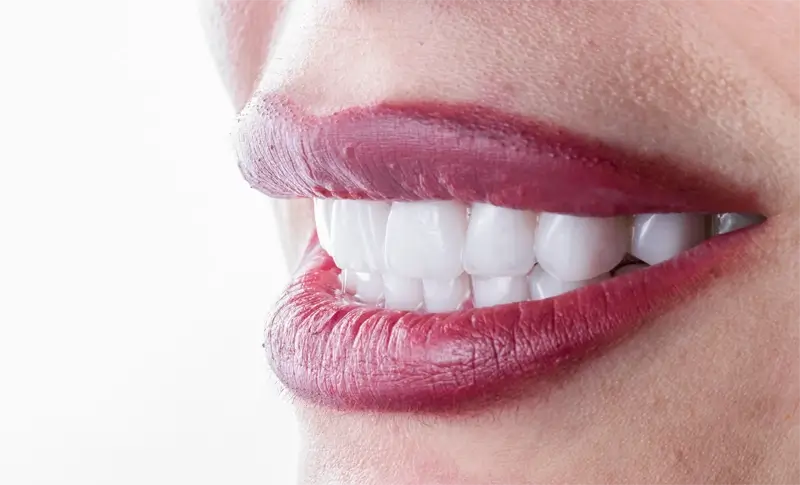 見た目が自然な歯に近づく