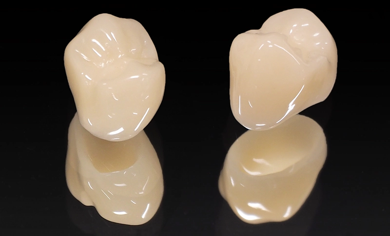 金属アレルギーのリスクがなくなる