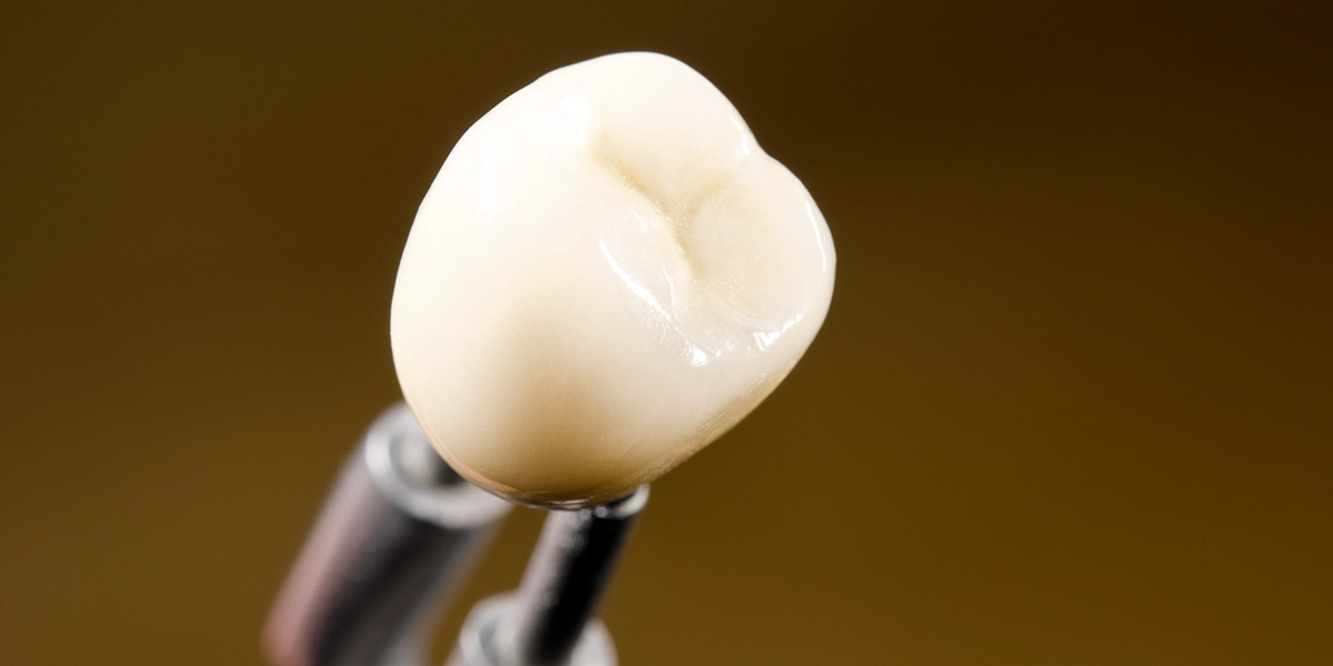 差し歯とセラミックを理解するための基礎知識